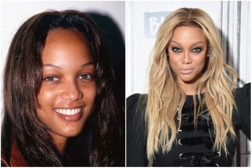 Tyra Banks before after