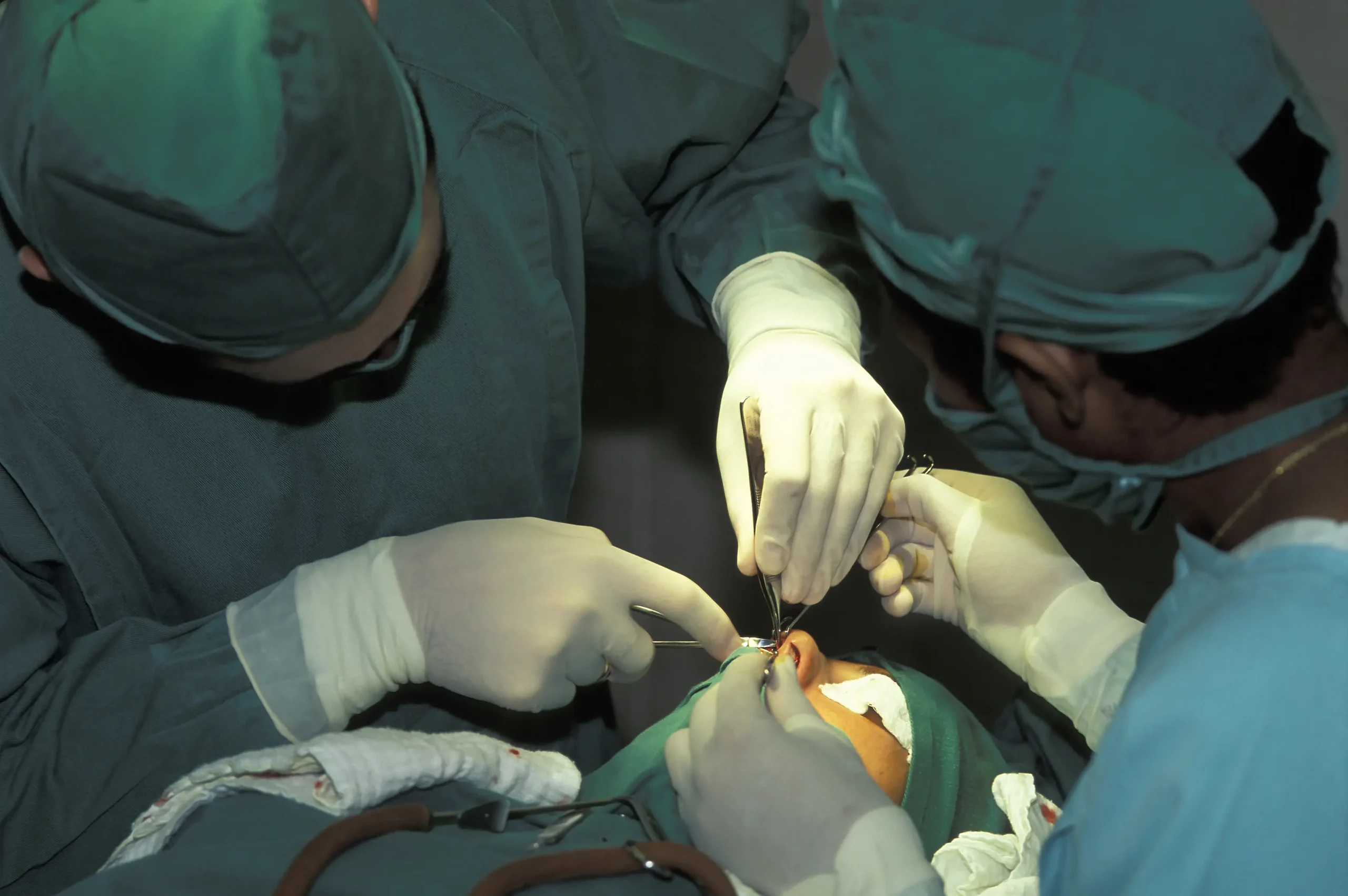 rhinoplasty operation