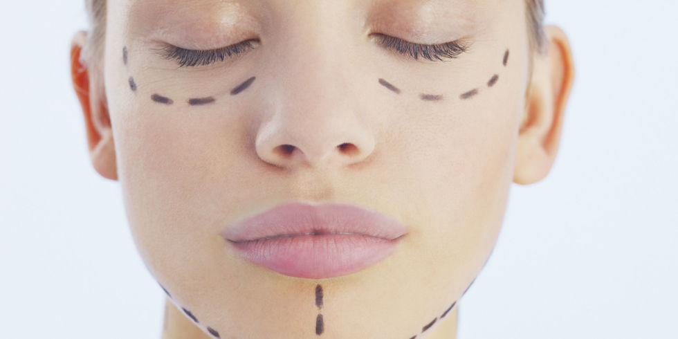 10 Things to Consider Before Getting Plastic Surgery