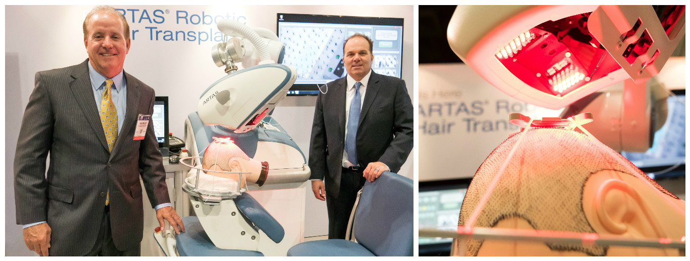 artas robotics hair transplant