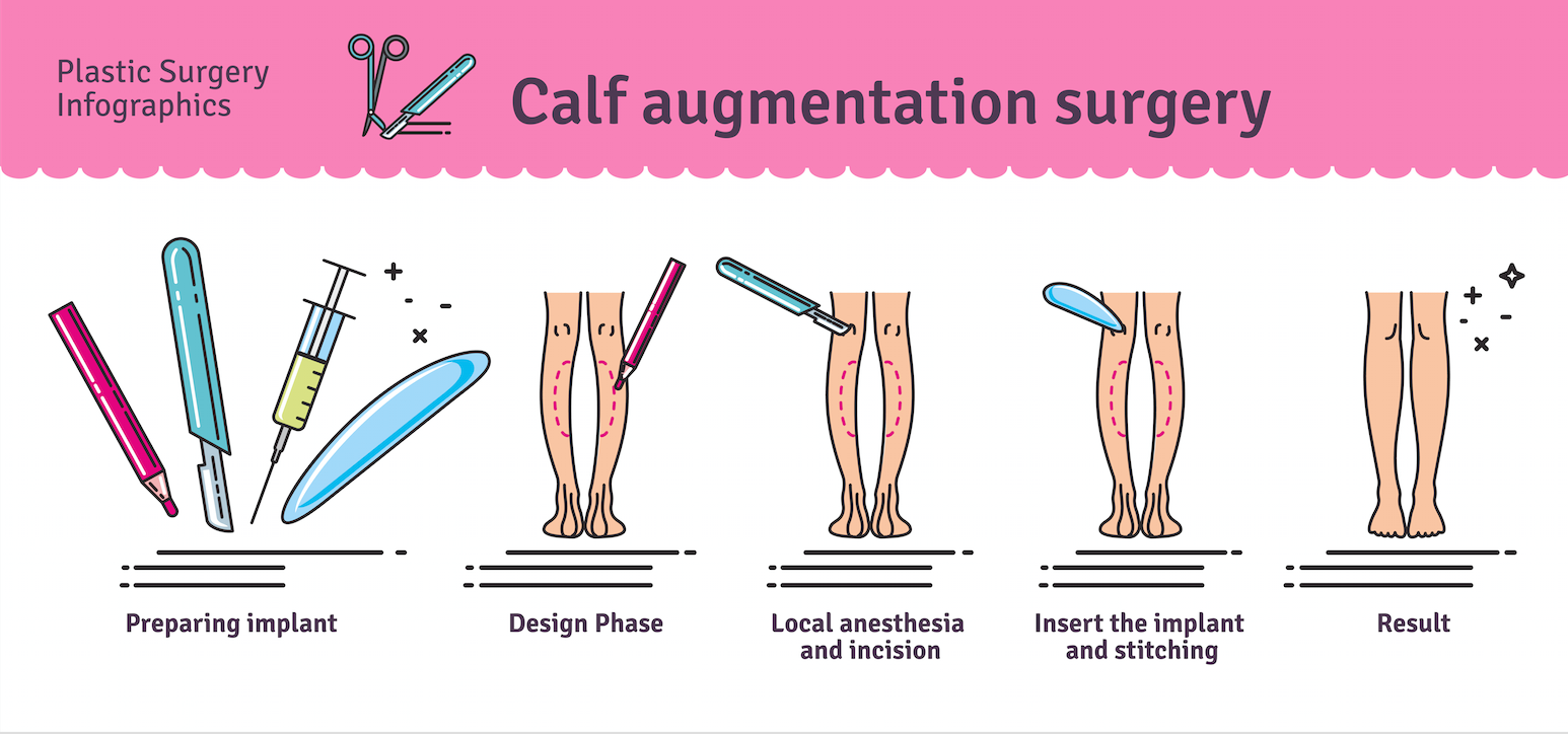 Calf Implants