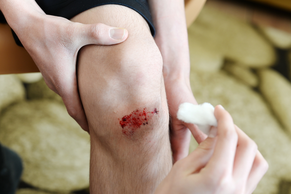 Wound Healing with Natural Products