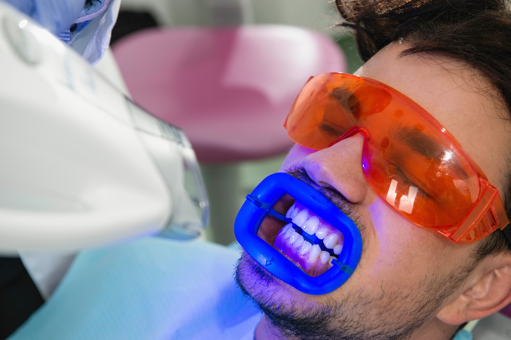 laser teeth