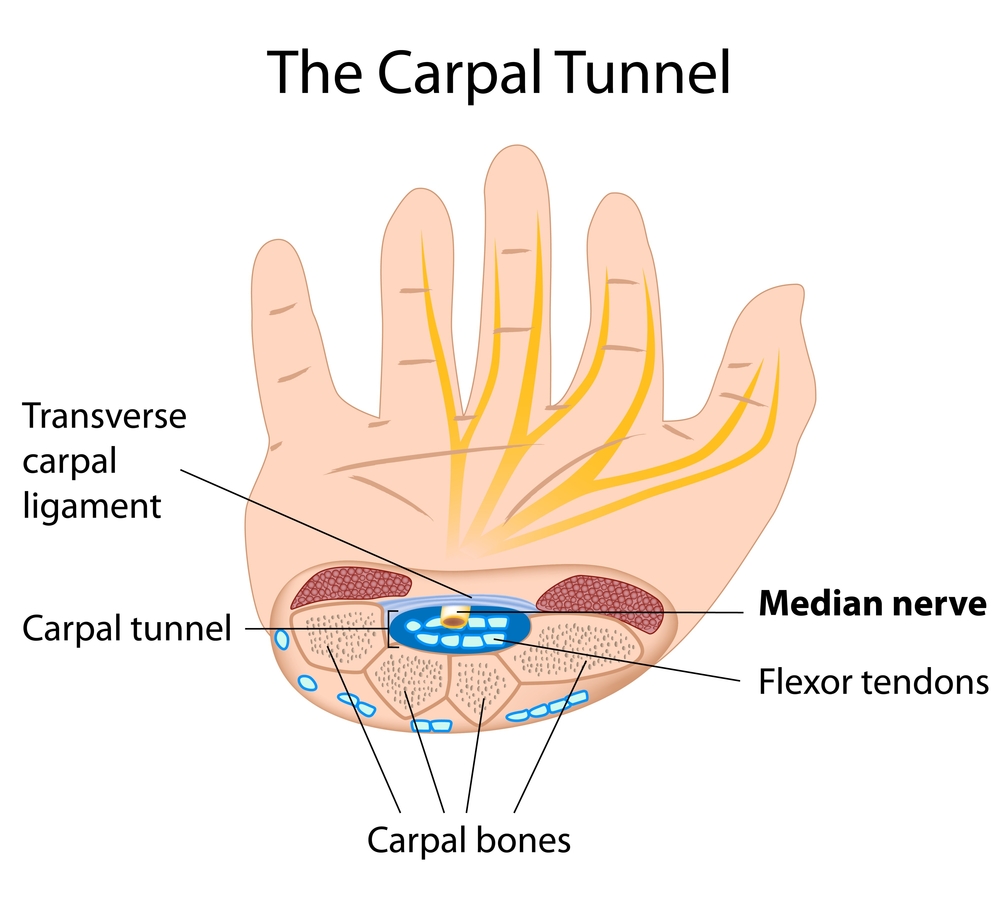 Carpal Tunnel Surgery