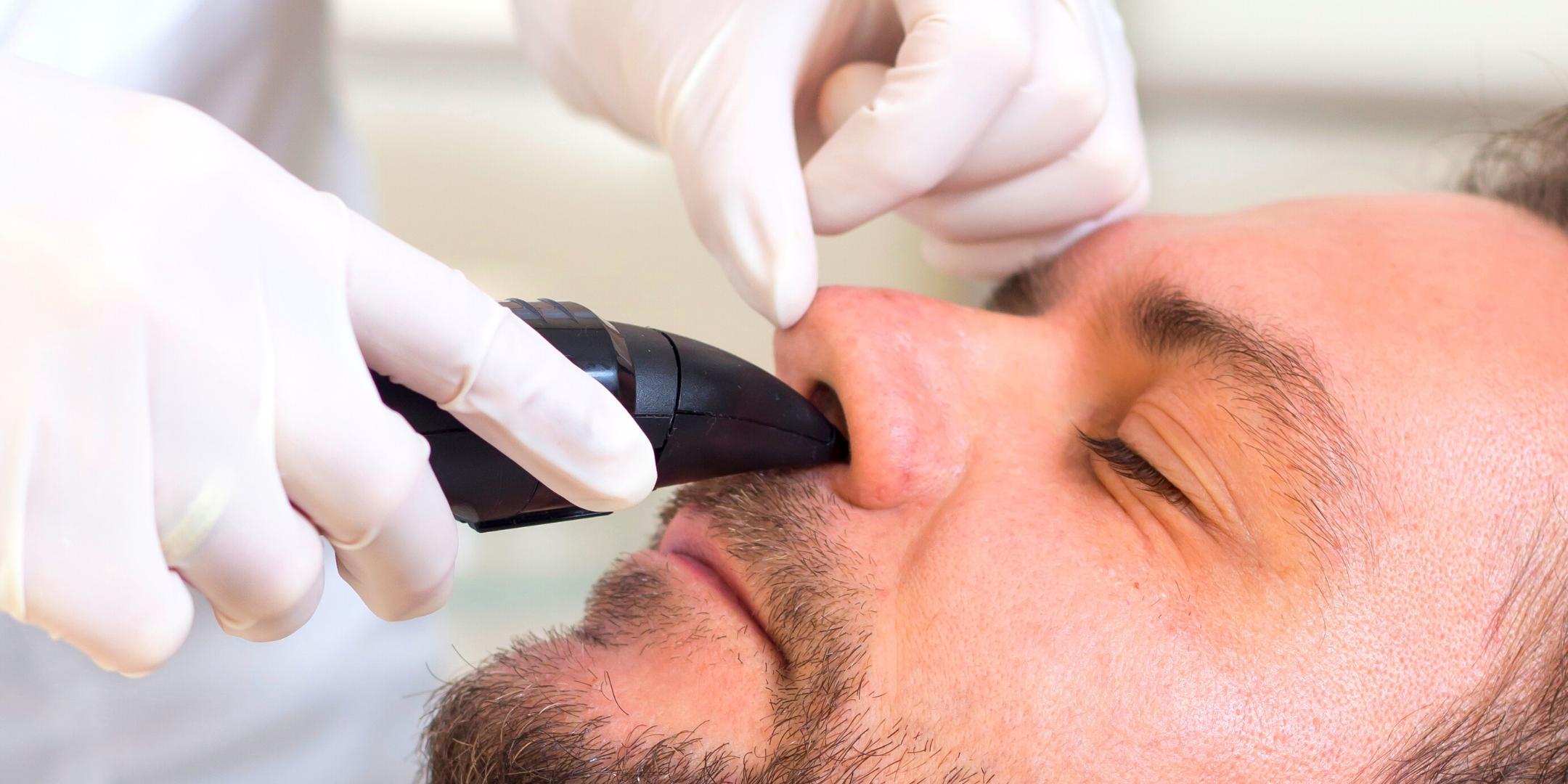 Is Laser Nose Hair Removal The Best Option?