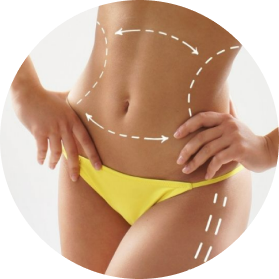 Liposuction As A Body Contouring Procedure: All You Need To Know