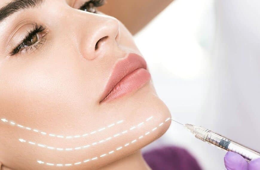 FaceLift Procedure- The What, Why, and How!