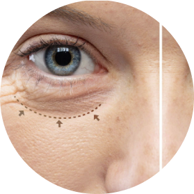 Complete Guide to Eyelid Surgery: Benefits, Techniques, and Recovery