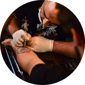 Tattoo Removal Options and Cost: What You Need to Know