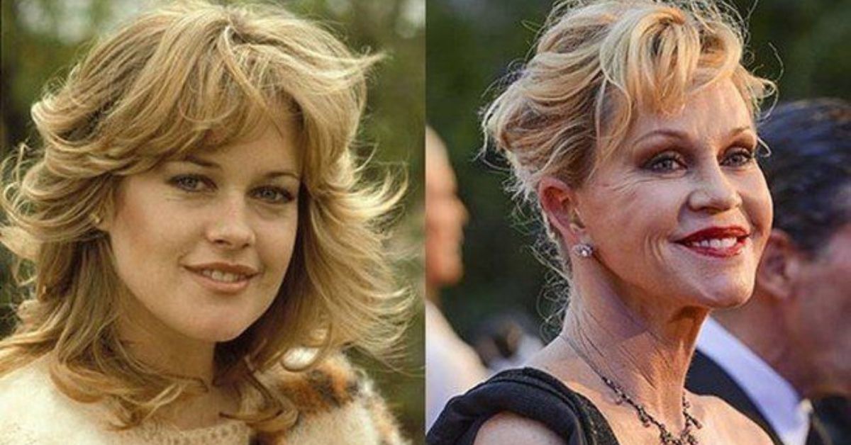 Celebrity Botched Liposuction