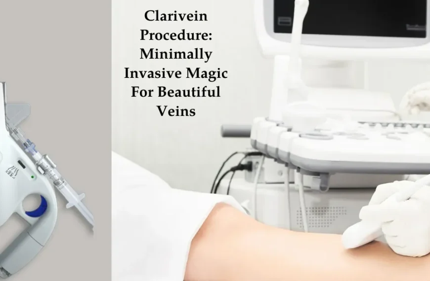 clarivein procedure