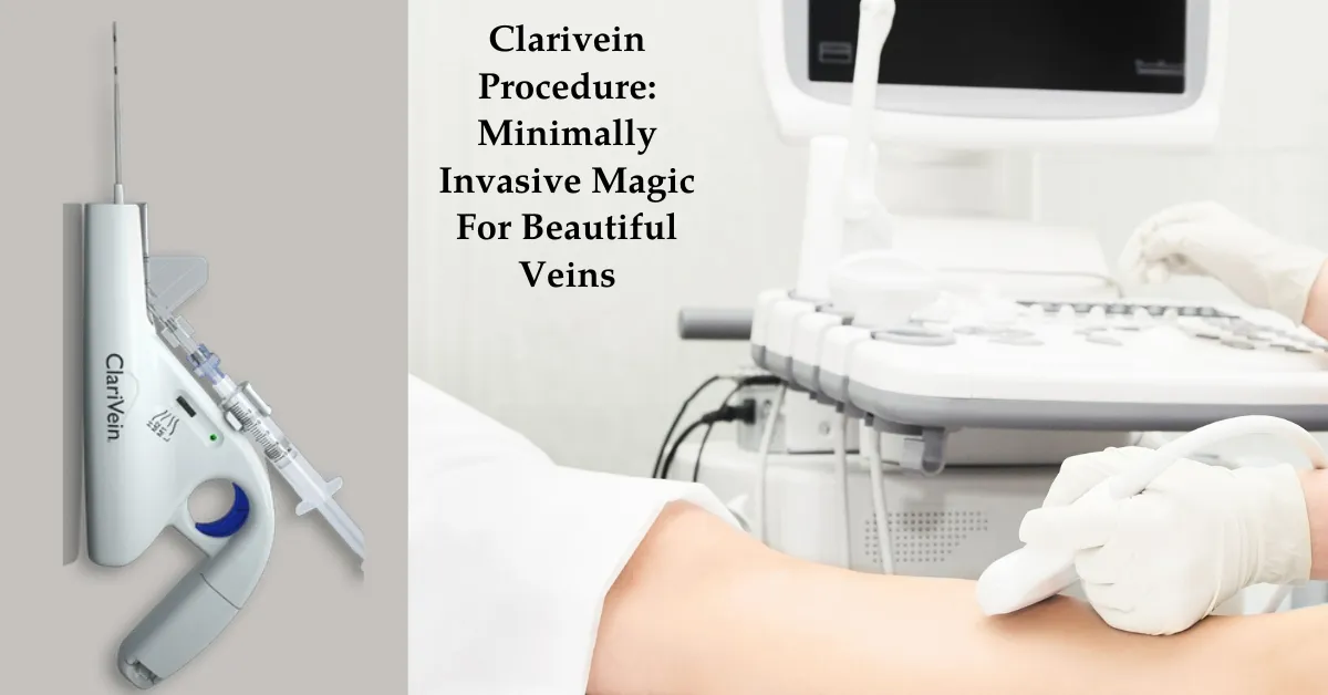 clarivein procedure